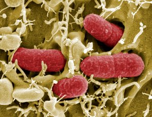 Для чего и кем создан смертельный штамм E.coli?