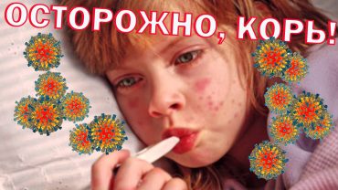 вспышка кори 2023